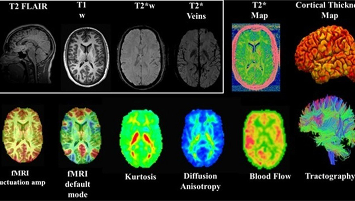 Image of MRI brain scans.