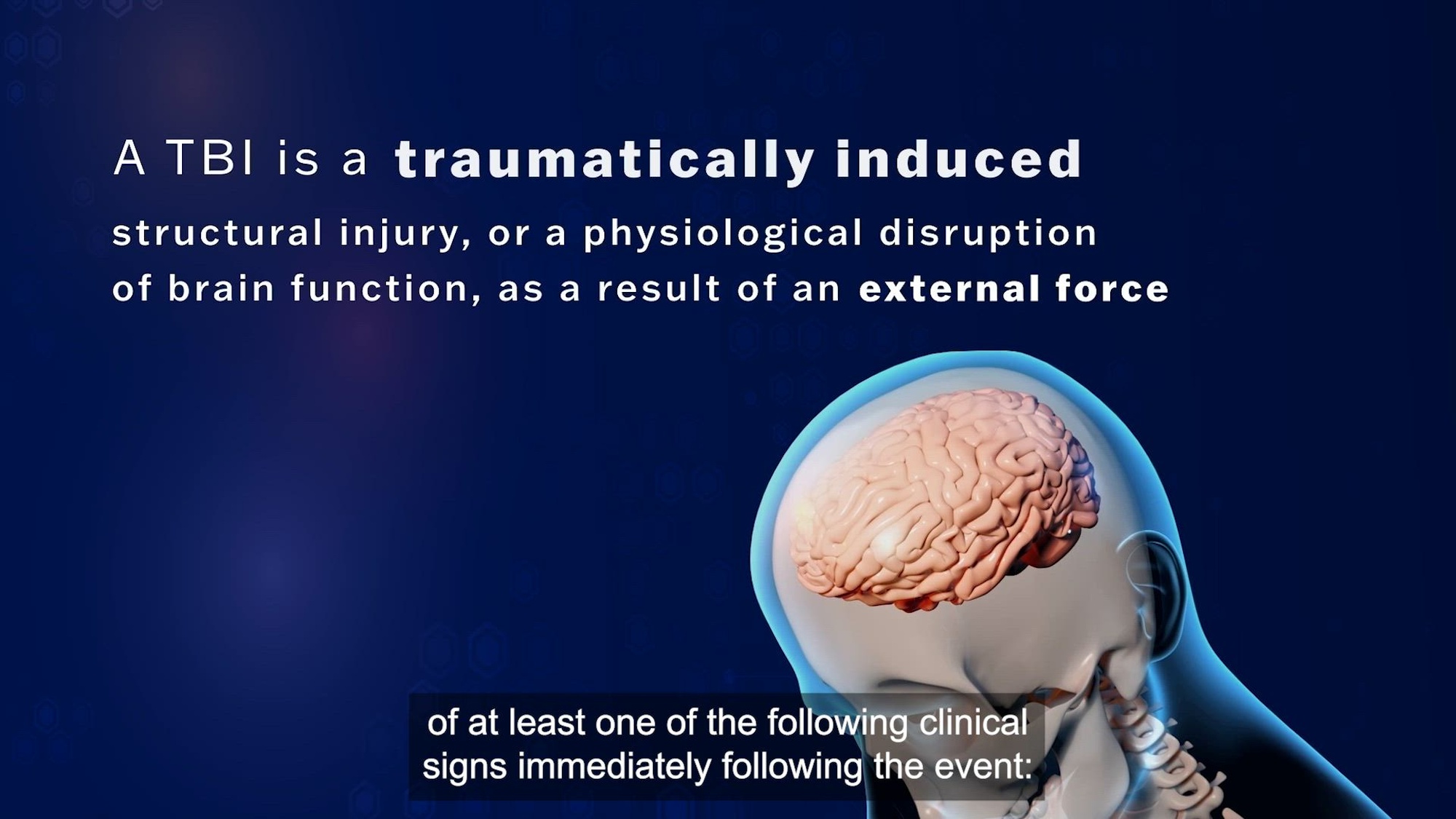 Link to Video: What Is a TBI?