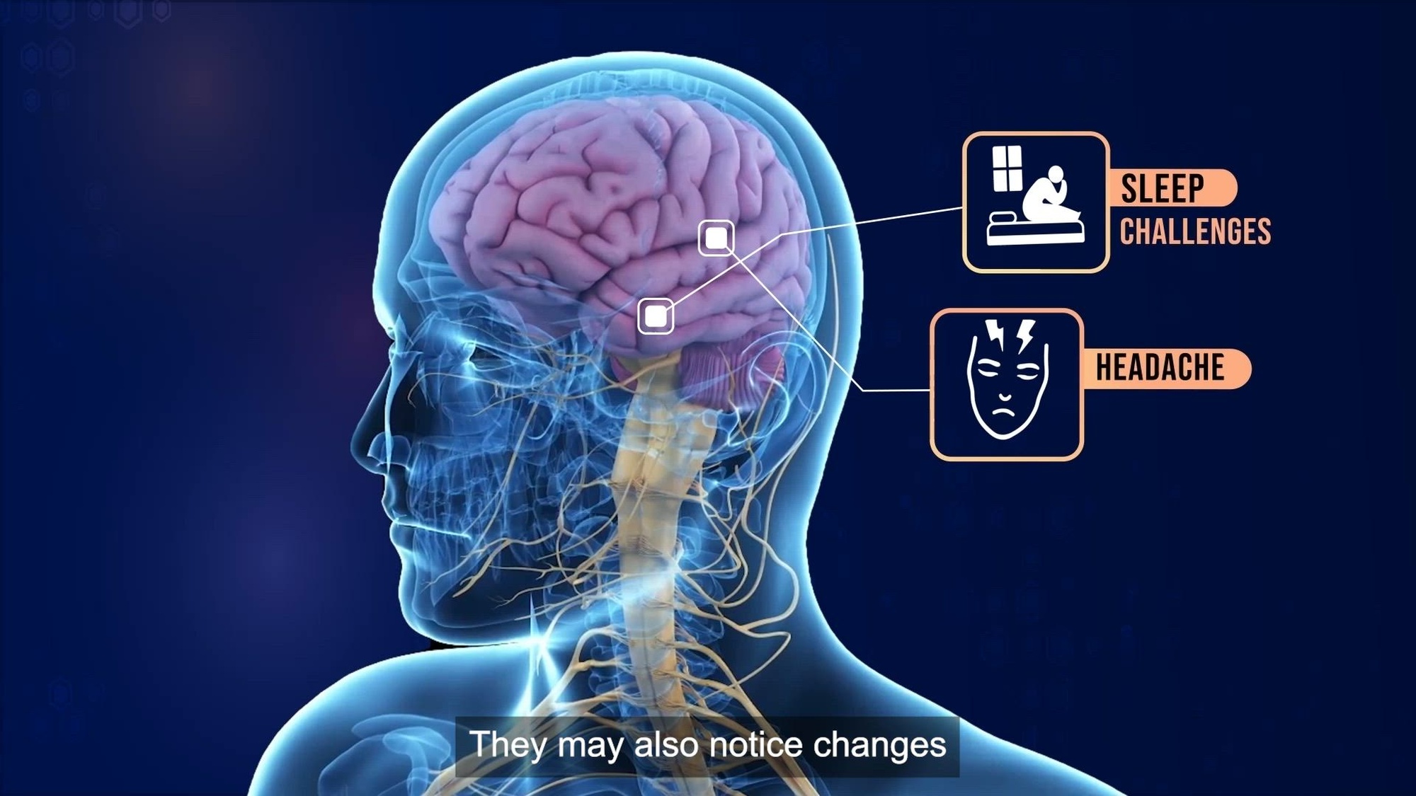 Link to Video: What Are TBI Symptoms?