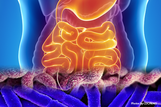Picture of the digestive system and the etiologic agents that cause acute gastroenteritis or travelers' diarrhea. Learn how enteric infections surveillance aids in protecting U.S. Armed Forces and improves readiness.
