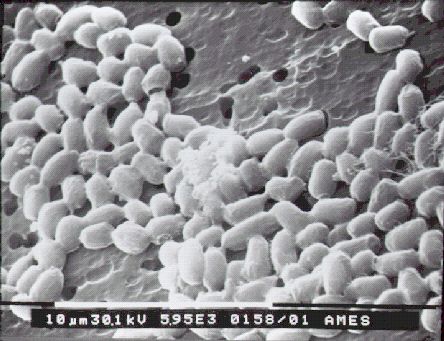 Figure 1. Scanning electron microscope image of Bacillus anthracis spores