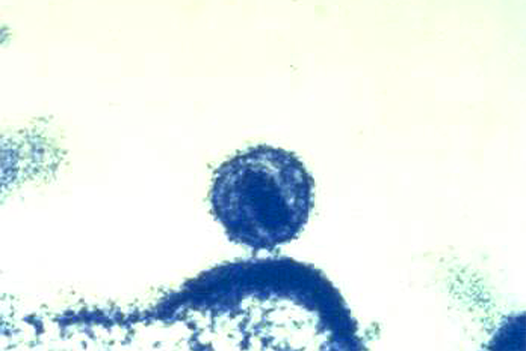 Image of 1National Institute of Allergy and Infectious Diseases NIAID 18142.