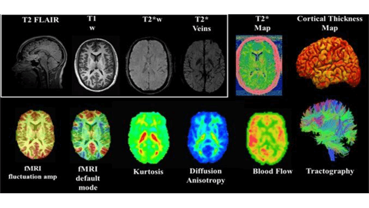Brain scan imaging