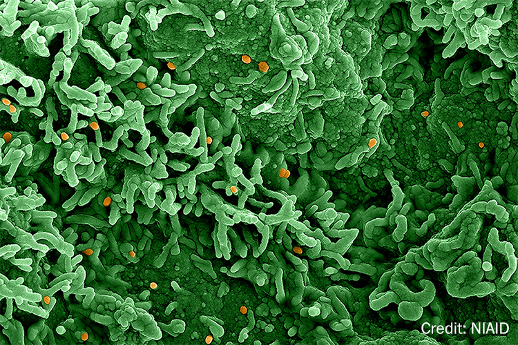 A colorized scanning electron microscopic image of the mpox virus on the surface of infected VERO E6 cells 