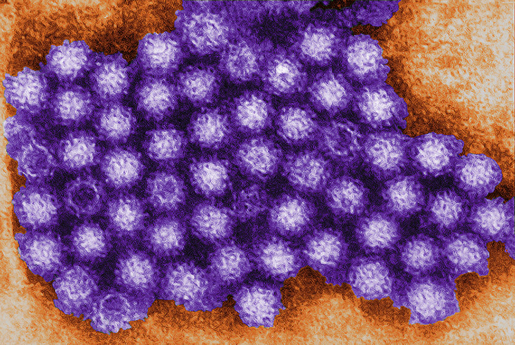 Norovirus are a group of related, single-stranded RNA, nonenveloped viruses that cause acute gastroenteritis in humans. (Photo Courtesy: CDC/Charles D. Humphrey