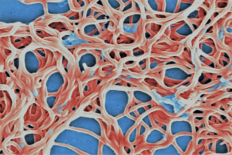 Digitally colorized scanning electron microscope image depicting a grouping of numerous, Gram-negative anaerobic Borrelia burgdorferi bacteria derived from a pure culture. Credit: CDC/Claudia Molins