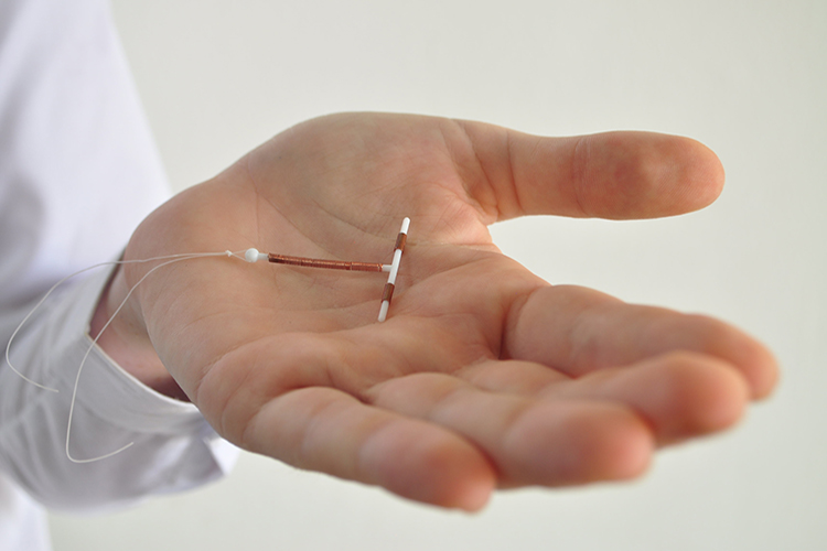 Image of A copper intrauterine device. Click to open a larger version of the image.
