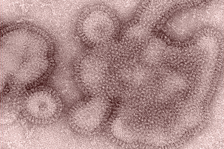 Image of Captured in 2011, this transmission electron microscopic (TEM) image depicts some of the ultrastructural details displayed by H3N2 influenza virions, responsible for causing illness in Indiana and Pennsylvania in 2011. See PHIL 13469, for the diagrammatic representation of how this Swine Flu stain came to be, through the “reassortment” of two different Influenza viruses.  Credit: CDC/ Dr. Michael Shaw; Doug Jordan, M.A.