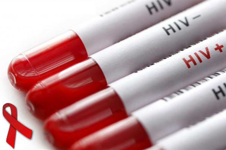 Image of HIV Awareness graphic showing test tubes with HIV + and HIV - labels.