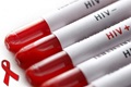 HIV Awareness graphic showing test tubes with HIV + and HIV - labels