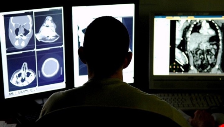 Image of A doctor looking at brain scans.