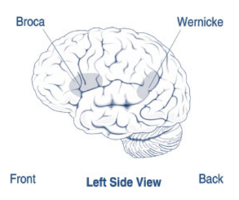 Diagram of the brain