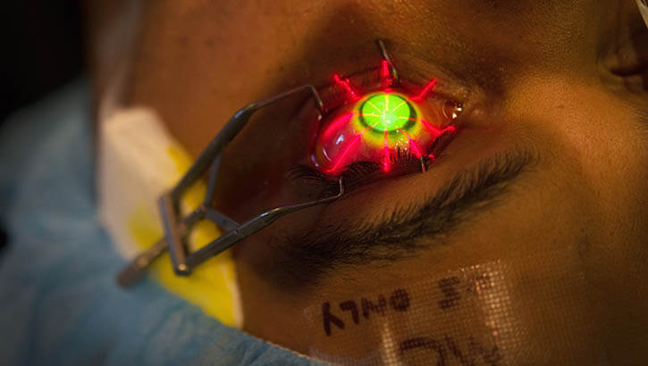 Links to Corneal Collagen Cross Linking in the Military a Game Changer