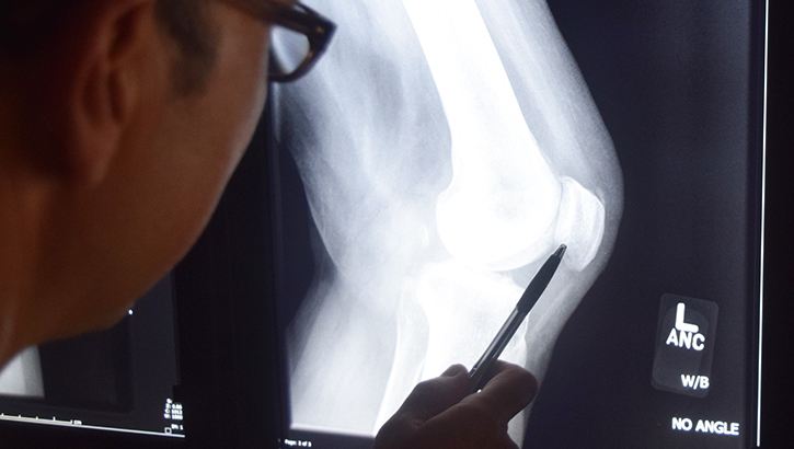 Image of Man looking at X-Ray. Click to open a larger version of the image.