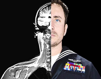A traumatic brain injury is a recoverable yet complex injury with a broad spectrum of symptoms including headaches, memory problems, attention deficits, mood swings, and others. The MACE 2 diagnostic tool allows for health care providers to assess service members more comprehensively after exposure to a concussive event to better determine their care pathway. (Photo: Navy Petty Officer 2nd Cl. Jonathan D. Chandler, Fleet Combat Camera Pacific)