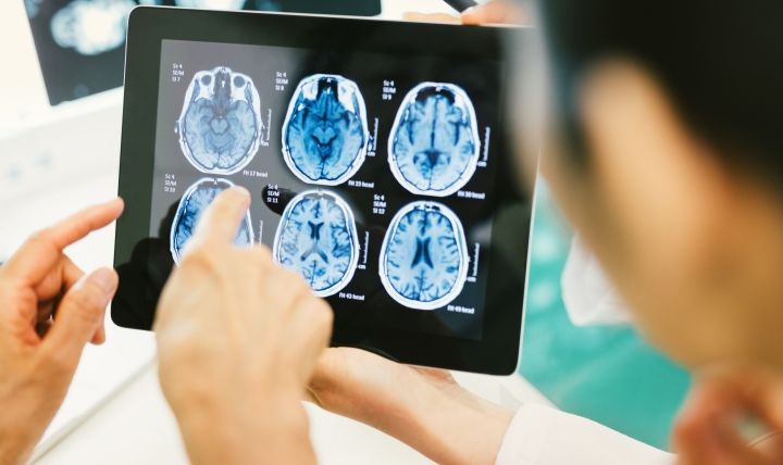 Traumatic brain injuries can happen anywhere. Regardless of how or when, all TBIs need medical attention, experts warn. (Photo courtesy of Walter Reed National Military Medical Center)