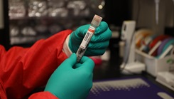 A laboratory technician prepares a blood sample collected from a burn patient for analysis